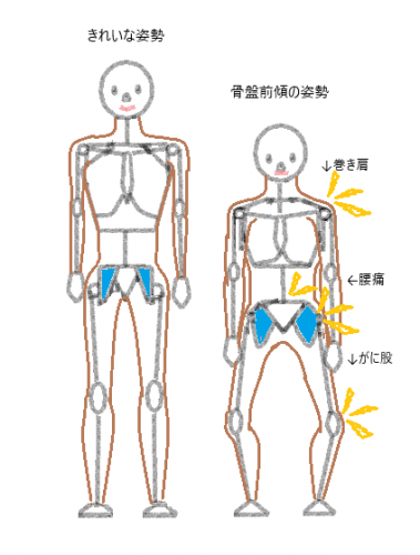 綺麗な姿勢、骨盤前傾の姿勢～前から～